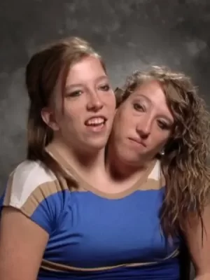 连体姐妹花:艾比和布列塔尼海报