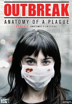 天花大爆发:瘟疫的解剖学海报