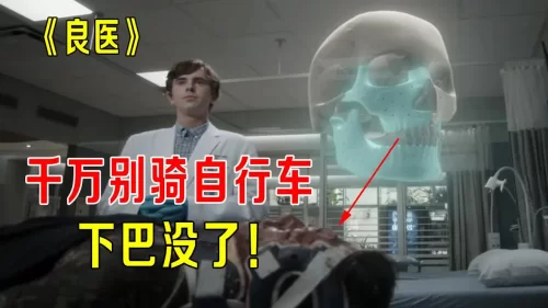 千万别骑自行车,病人下巴没了,五官严重毁容,天才<良医>出大招!海报